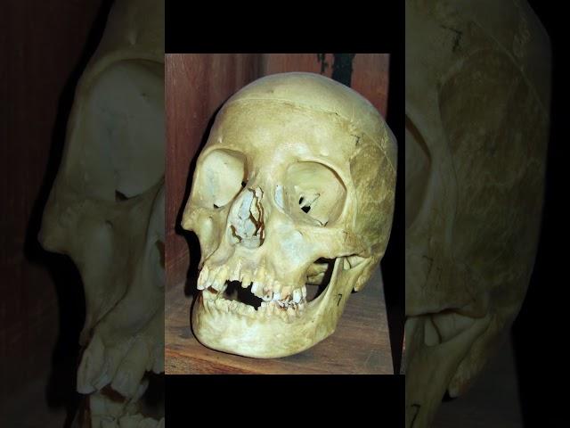 Toltec Monk - Sticky Skulls