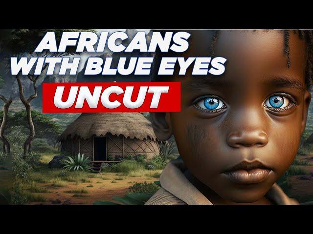 Africans with Blue Eyes | Rarest Eye Colors in Africans