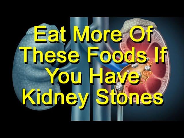 Eat More Of These Foods If You Have Kidney Stones