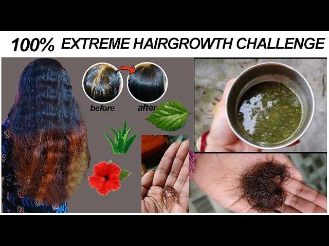 Homemade hair mask for hair growth, Sliky & Shiny|Home Remedies Extreme Grow Hair#hairfall