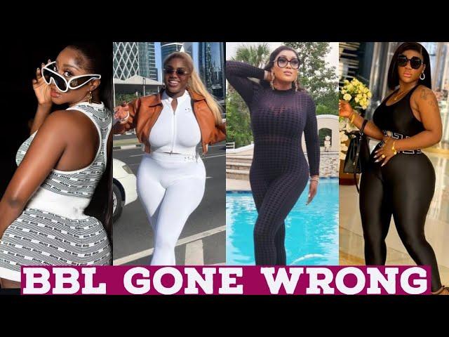 15 Nollywood Actresses With The Worst Plastic surgery (BBL)