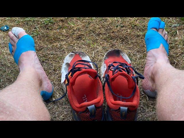 Running a 300 Mile Ultra Race [Trailer]