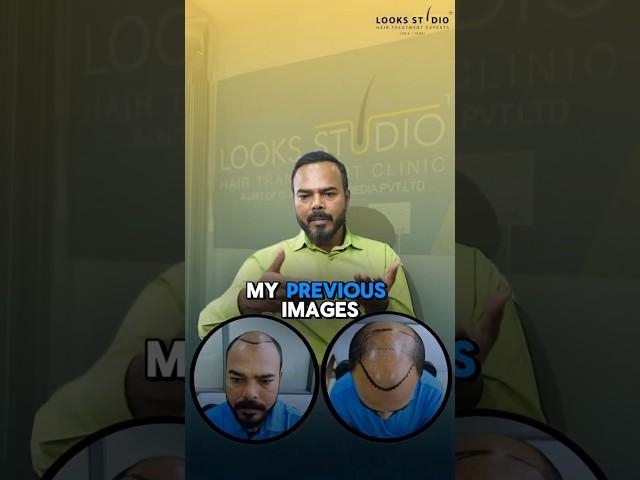 Mr. Gaurav’s Amazing Hair Transformation with Looks Studio!