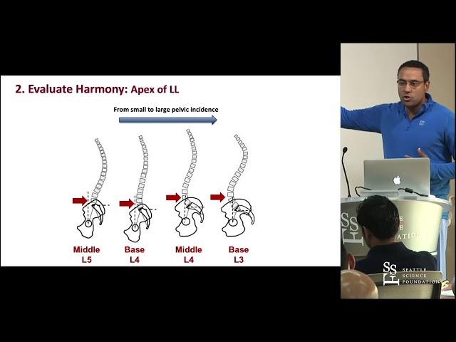 Sagittal Balance and Parameters - David O. Okonkwo, MD, PhD