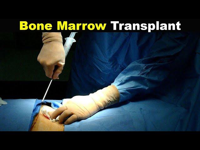 How Does Bone Marrow Transplant Works? (Urdu/Hindi)