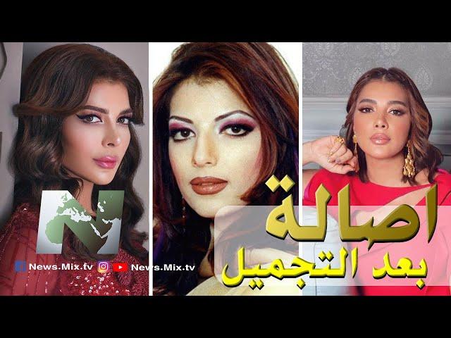 أصالة بعد عملية التجميل