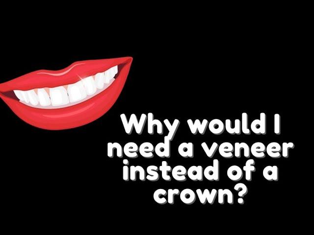 Veneer Vs. Crown