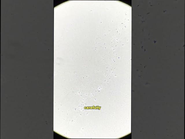 This bacteria DIDNT STAND a CHANCE!