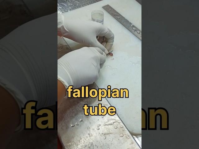Fallopian tube biopsy sample| #histopathology #histomuseum #fallopiantubes #fallopiantubeblockage