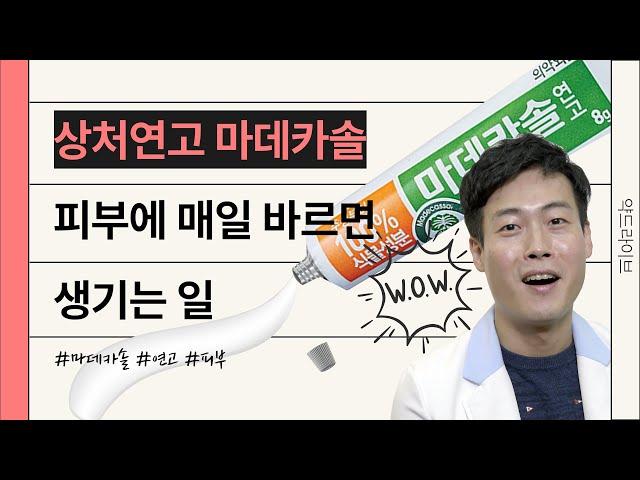 상처연고 마데카솔 피부에 매일 바르면 생기는 일