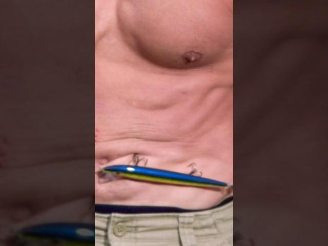 Fishing Hooks VS Human Flesh! #funny #fishing #comedy