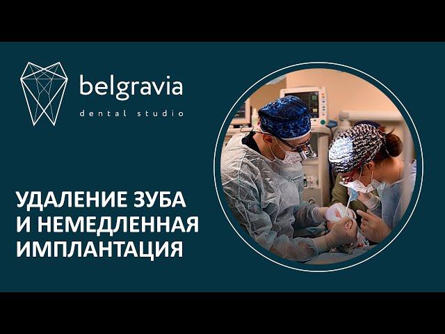  Удаление зуба и немедленная имплантация в Belgravia dental studio