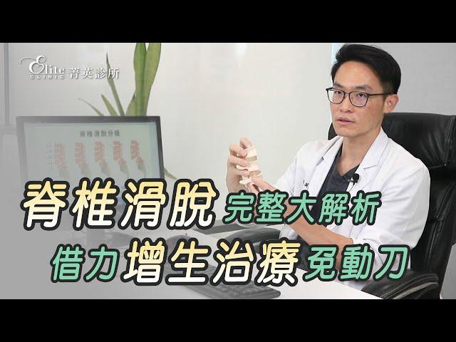 脊椎滑脫完整大解析，借力增生治療免動刀！尤稚凱醫師