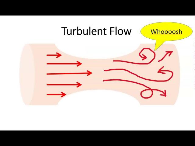 Blood Flow and Korotkoff Sounds