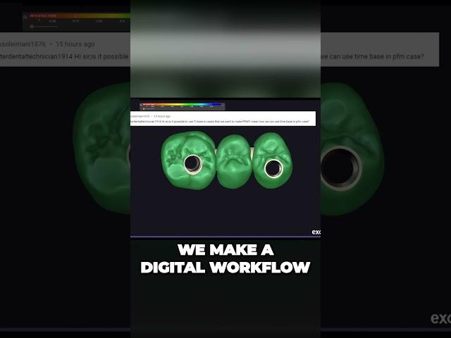 Revolutionize Your Workflow Digitizing Ti Bases and Split File PFM Restoration