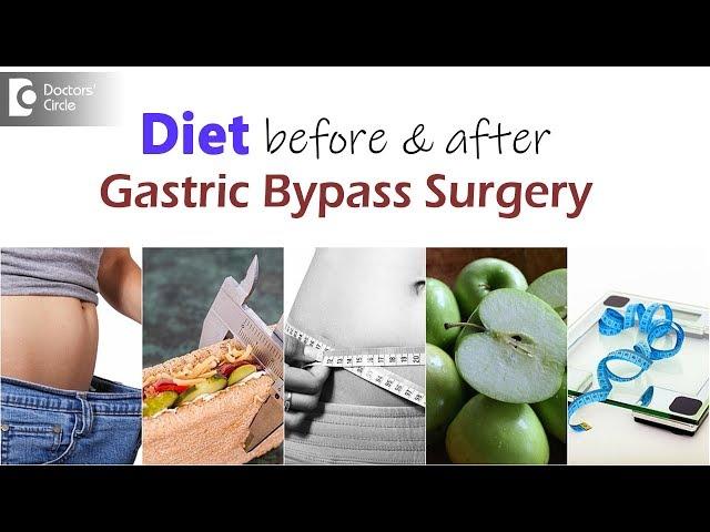 What is the pre op and post op diet for gastric bypass? - Dr. Nanda Rajaneesh