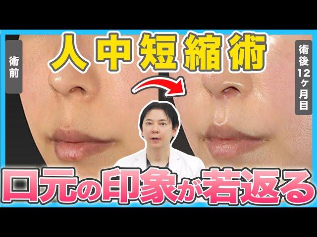 人中短縮術で口元が若返る！症例写真とともに施術方法や適応を徹底解説