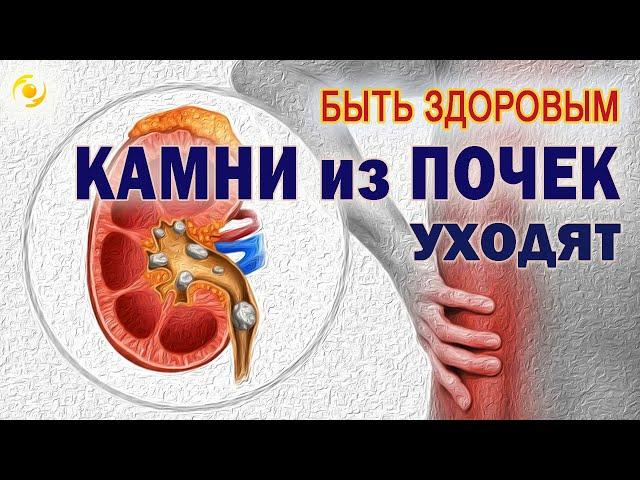 КАМНИ из почек УХОДЯТ!!! Помогают МИКРОСФЕРЫ ️️️