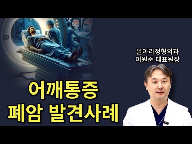 어깨통증 원인 폐암 발견사례