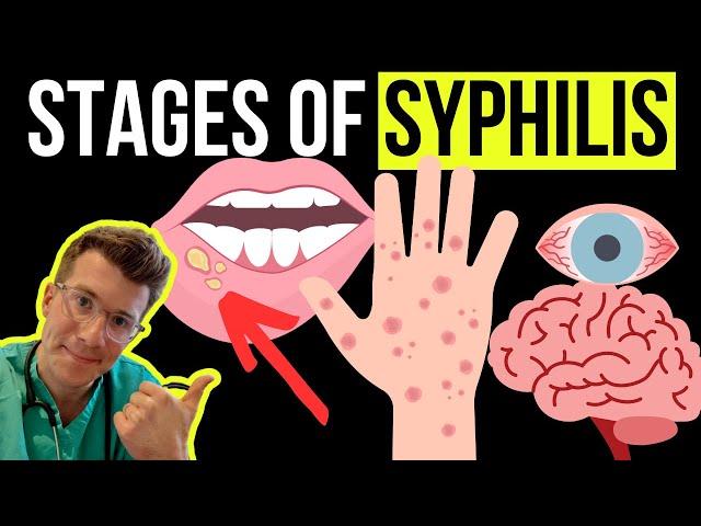 Doctor explains the Symptoms and Stages of SYPHILIS (STI)