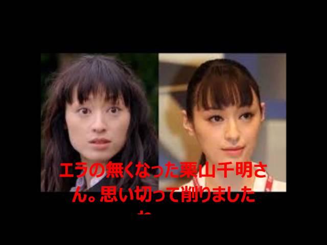 【エラ削り】栗山千明の整形ビフォーアフター画像【目頭切開　二重整形】