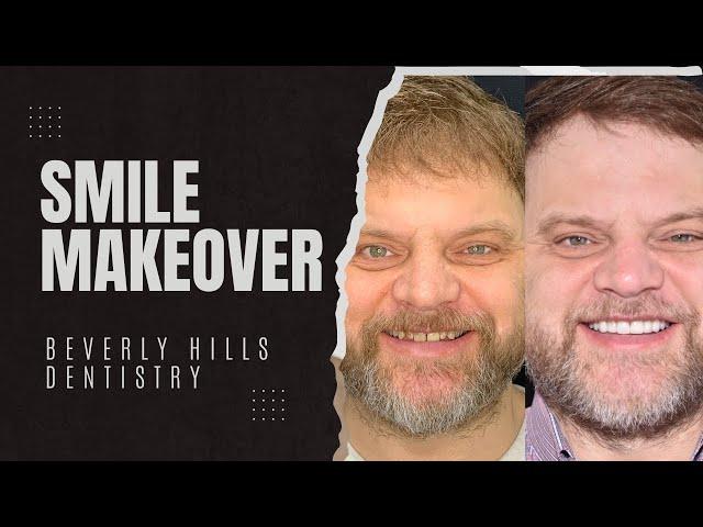 Listen to Chris's Smile Makeover experience | Beverly Hills Dentistry