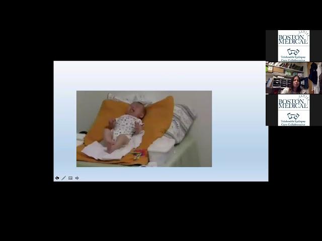 Mimickers of Seizures (Year 1, Session 2)