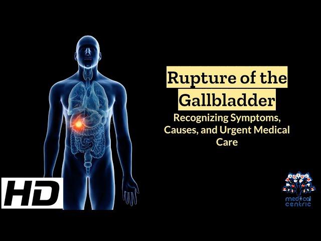 Ruptured Gallbladder: Emergency Signs, Causes, and Lifesaving Tips