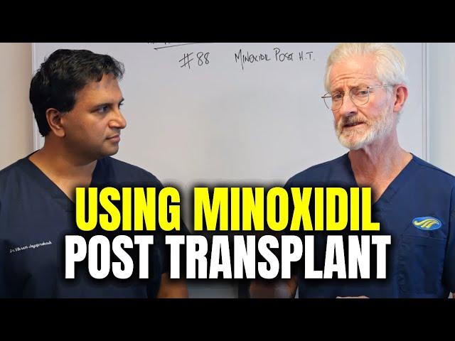 The Role of Minoxidil Post Hair Transplant