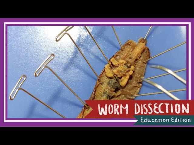 Worm Dissection || What are Worms Hiding Underneath Their Skin? [EDU]
