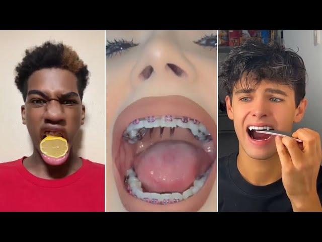 All Your TikTok Dental Pain In One Video!