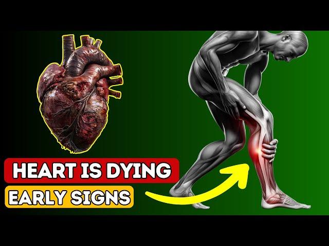 HEART IS DYING! 12 Weird Signs Of HEART DAMAGE | Vitazen Health