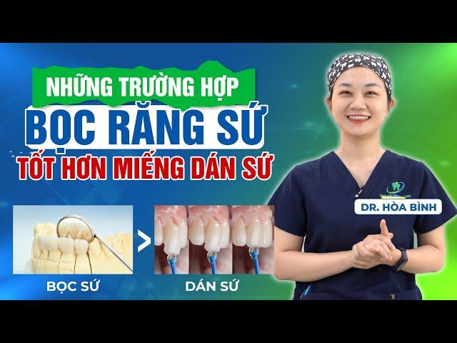 TRƯỜNG HỢP NÀO NÊN CHỌN RĂNG SỨ THAY VÌ DÁN SỨ VENEER?