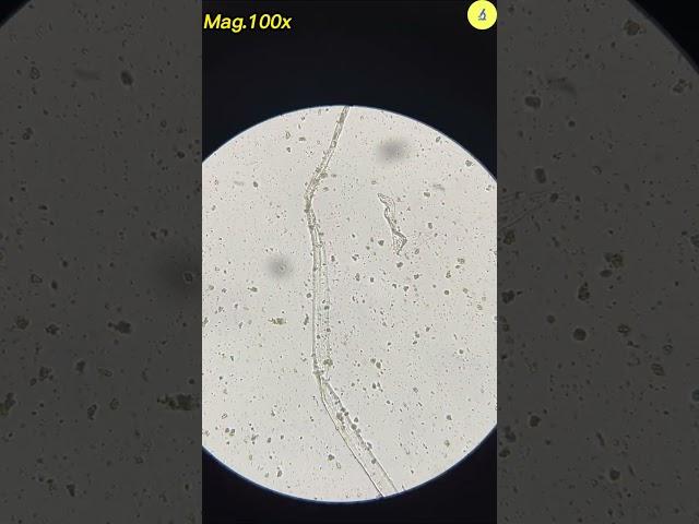 Condom Under Microscope | TULO - Microscope #shorts #underthemicroscope #condom