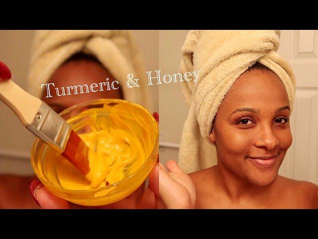 DIY Turmeric Face Mask for Hyperpigmentation & Acne Scars 