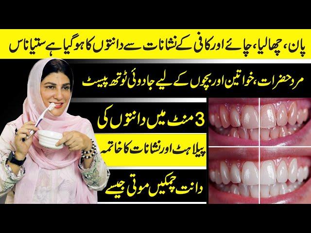 Turn Dirty Yellow Teeth to Pearl White in Just 3 Minutes | Plaque & Tartar Removal