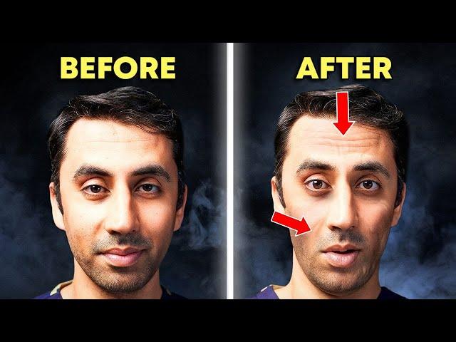 The Truth Behind Ozempic Face (Wegovy) | Doctor Explains