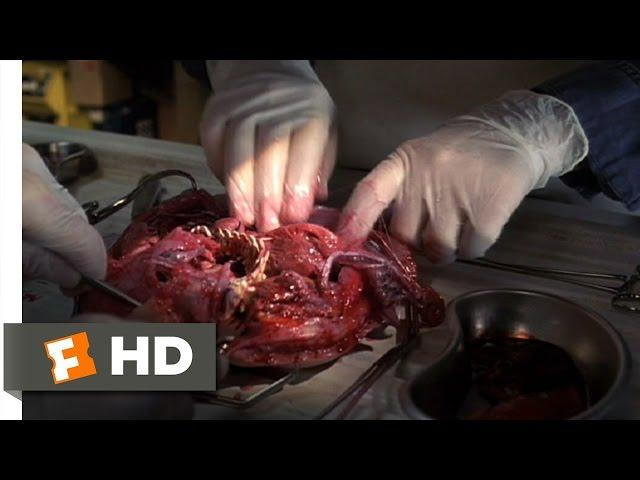 eXistenZ (3/10) Movie CLIP - Bio-Pod Surgery (1999) HD