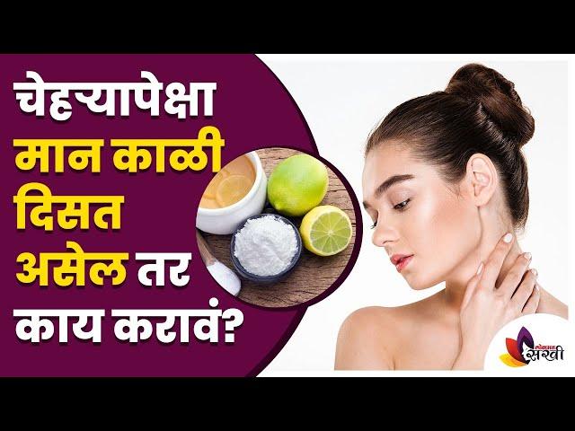 चेहऱ्यापेक्षा मान काळी दिसत असेल तर काय करावं? Remove tan on the neck | Best Home Remedies