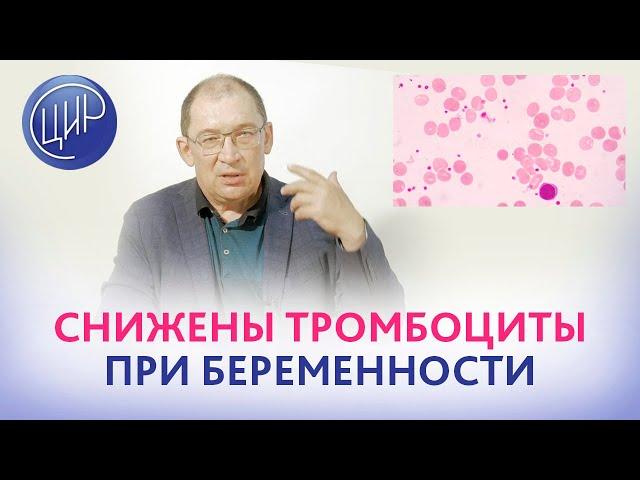 Моноклональная гаммапатия, понижены тромбоциты при беременности. Что делать? Игорь Иванович Гузов.