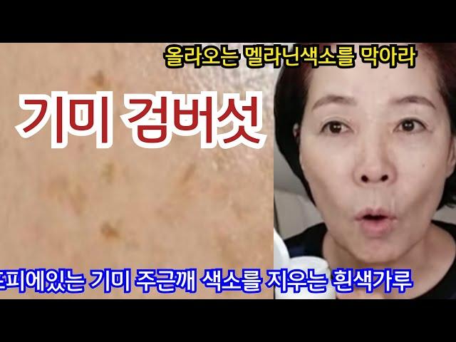 겉기미 주근깨 색소 검버섯을싹지워라/기미스킨/지혈제로 기미미백스킨만들기/트라넥삼산미백효소스킨