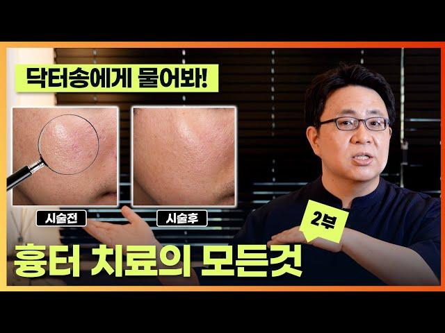 흉터 치료의 모든 것 2부/흉터치료 하는 시기/흉터예방법/상처난후 관리방법