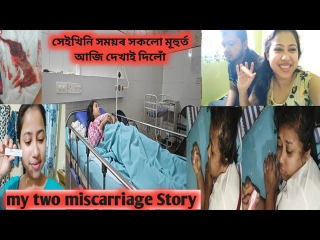 কেনেকৈ মই মোৰ দুটা সন্তান হেৰুৱাইইছিলো/ My two miscarriage Story/কিমান ভালকৈ ৰাখিছিলো memory খিনি