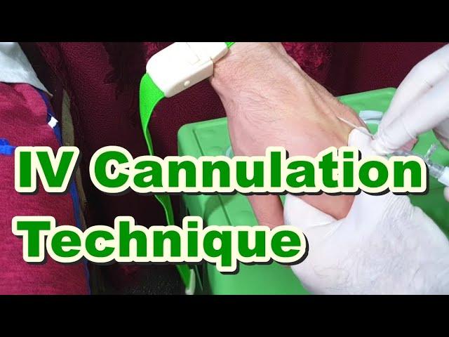 How to Insert IV Cannula | IV Cannulation Technique | Branula | Intravenous Catheter
