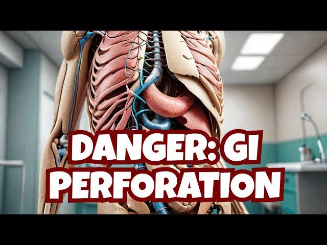 Gastrointestinal Perforation