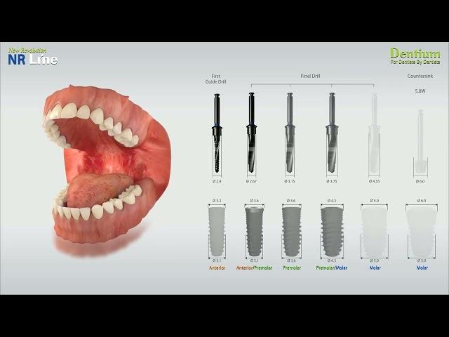 Dentium NR Line