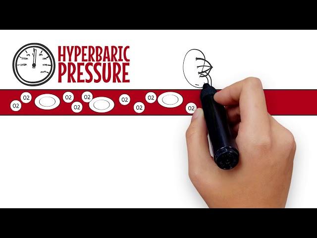 Simple Explainer Video on How Hyperbaric Oxygen Therapy Works.  Best Method.