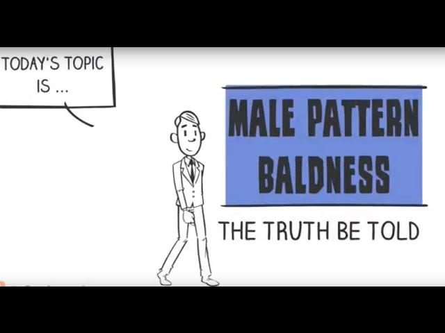 Male Pattern Baldness - Truth Be Told