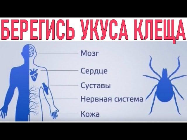 ОПАСНЫЙ КЛЕЩ | 13 симптомов боррелиоза которые нельзя пропустить