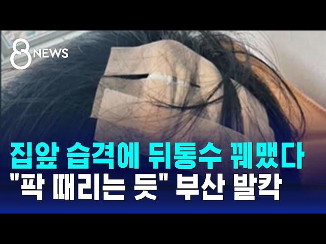 집앞 습격에 뒤통수 꿰맸다…"팍 때리는 듯" 부산 발칵 / SBS 8뉴스